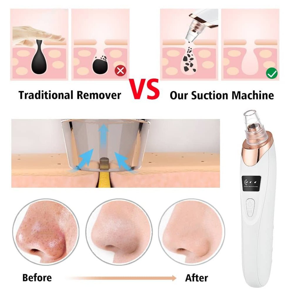 5 in 1 Blackhead remover | Derma Suction  | Rechargeable | Free Gift Card 🎁